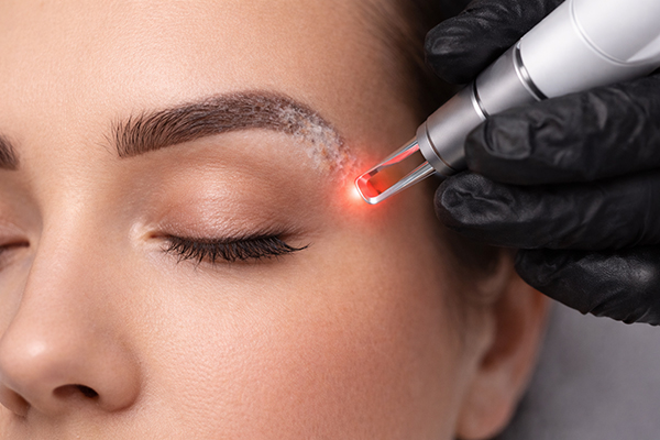Laserowe usuwanie makijażu permanentnego