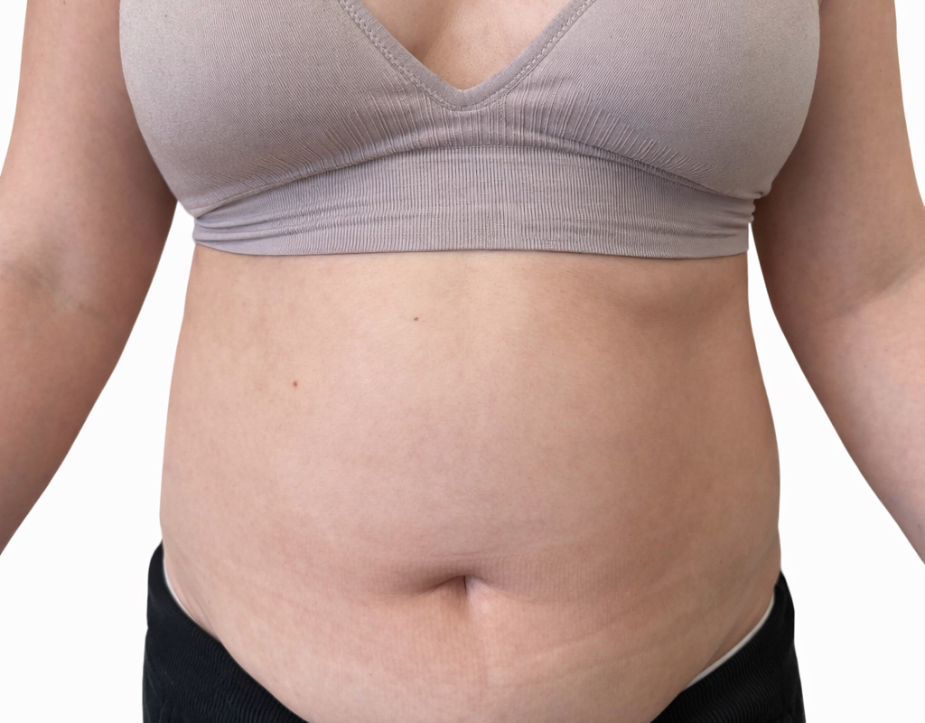 Do endermologia