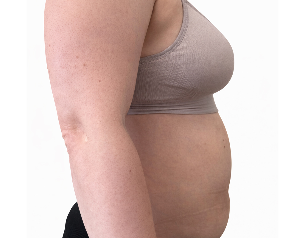 Do endermologia2
