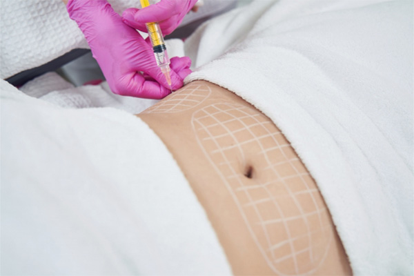 Lipo