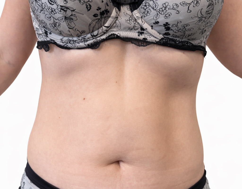 Po endermologia